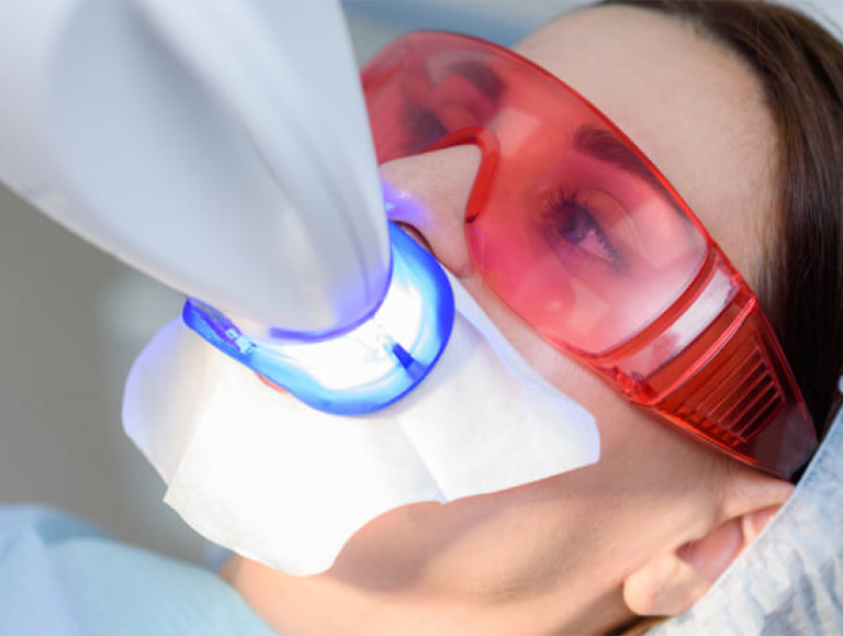 Teeth Whitening in Doylestown, OH